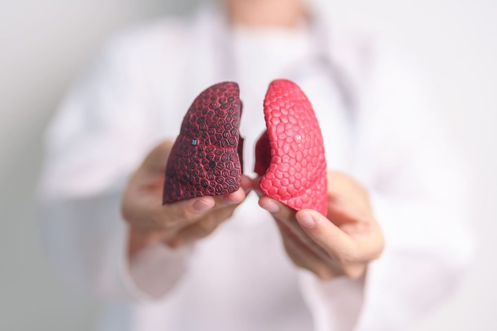 Lung cancer