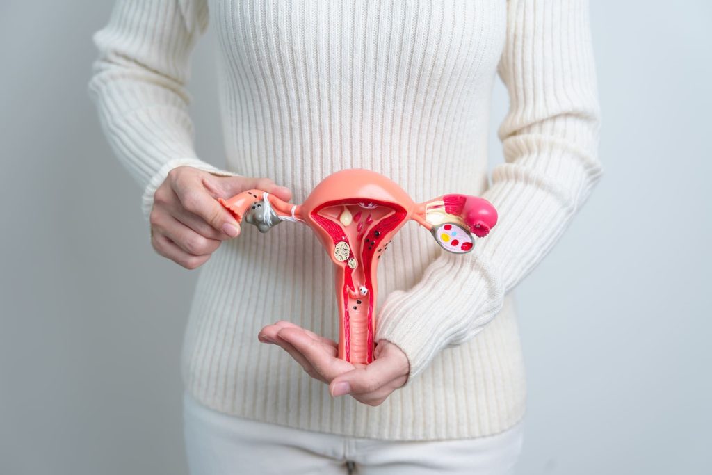 Pelvic Gynaecological Tumours