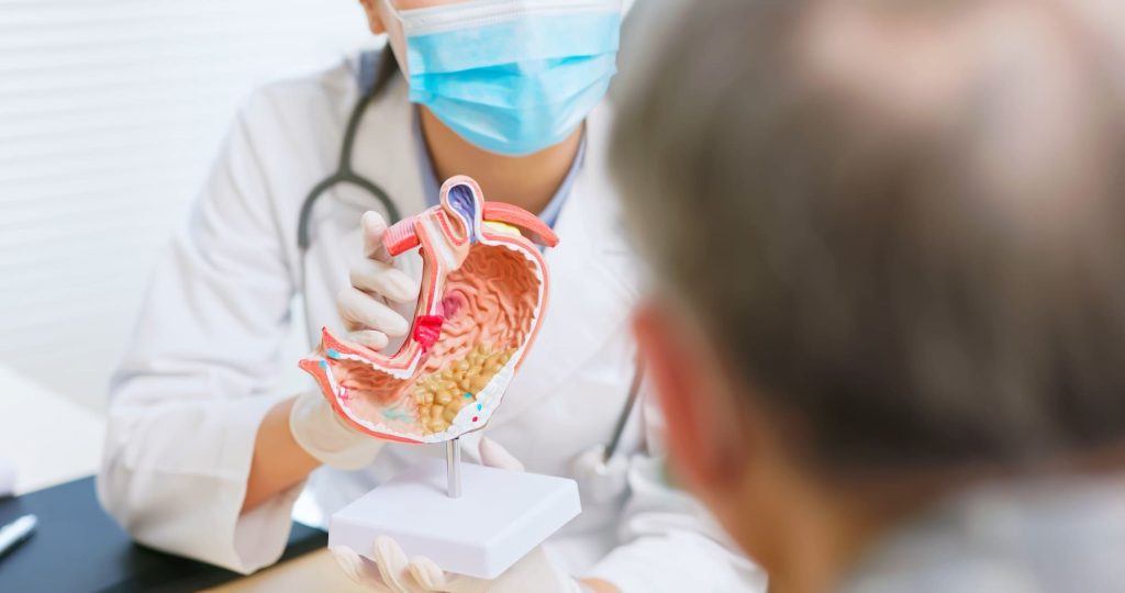 Esophageal cancer